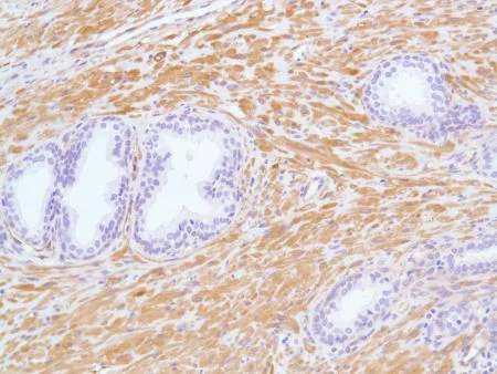 Immunohistochemistry (Formalin/PFA-fixed paraffin-embedded sections) - Anti-Vinculin antibody [SP117] - C-terminal (AB111004)