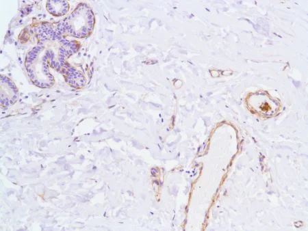 Immunohistochemistry (Formalin/PFA-fixed paraffin-embedded sections) - Anti-Vinculin antibody [SP117] - C-terminal (AB111004)