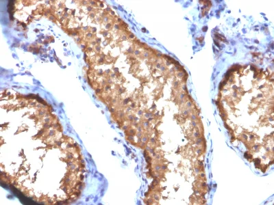 Immunohistochemistry (Formalin/PFA-fixed paraffin-embedded sections) - Anti-Vinculin antibody [VCL/2572] (AB238075)