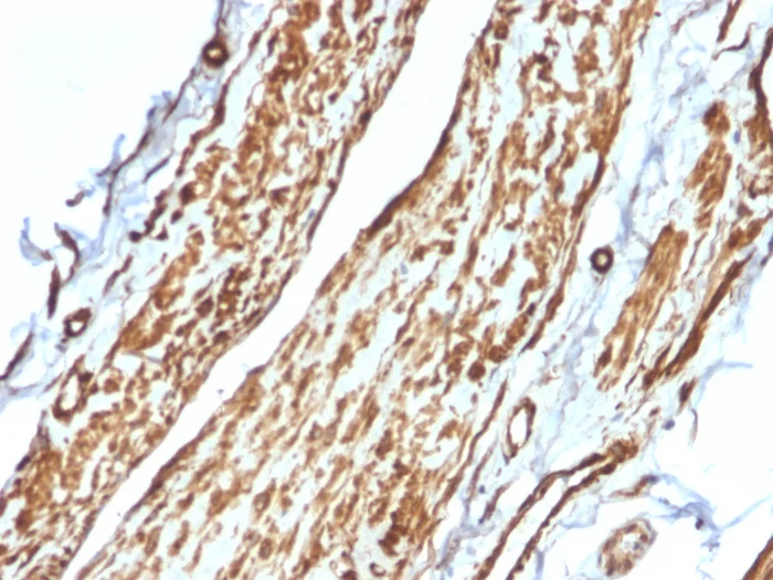 Immunohistochemistry (Formalin/PFA-fixed paraffin-embedded sections) - Anti-Vinculin antibody [VCL/2575] - BSA and Azide free (AB269690)