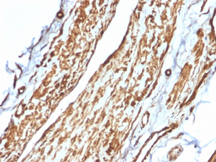 Immunohistochemistry (Formalin/PFA-fixed paraffin-embedded sections) - Anti-Vinculin antibody [VCL/2575] (AB269680), expandable thumbnail