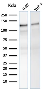 Western blot - Anti-Vinculin antibody [VCL/2575] - Loading Control (AB269680)