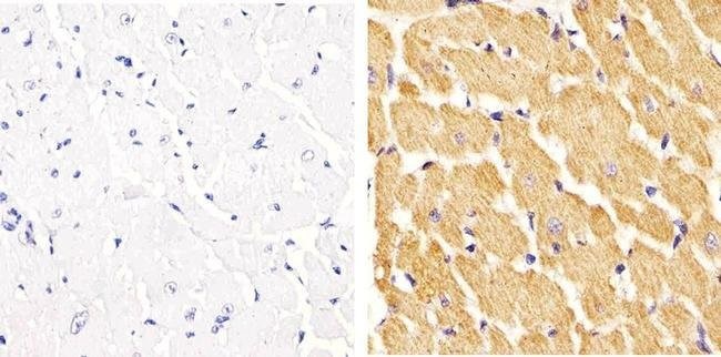 Immunohistochemistry (Formalin/PFA-fixed paraffin-embedded sections) - Anti-Vinculin (phospho Y822) antibody (AB200825)