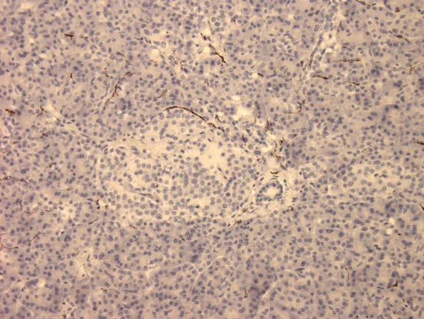 Immunohistochemistry (Formalin/PFA-fixed paraffin-embedded sections) - Anti-VIP antibody [02] (AB30680)