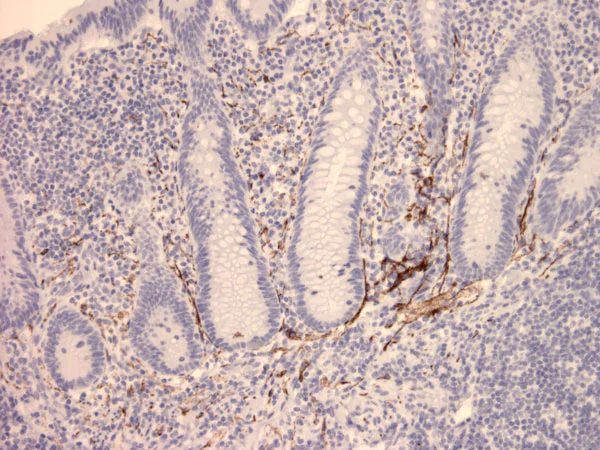 Immunohistochemistry (Formalin/PFA-fixed paraffin-embedded sections) - Anti-VIP antibody [02] (AB30680)