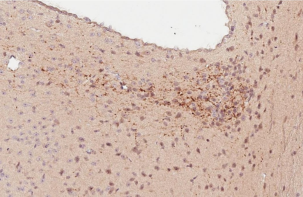 Immunohistochemistry (Formalin/PFA-fixed paraffin-embedded sections) - Anti-VIP antibody - C-terminal (AB227850)