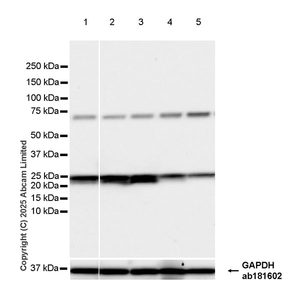 Western blot - Anti-VIP antibody [EPR28121-6] (AB324196), expandable thumbnail