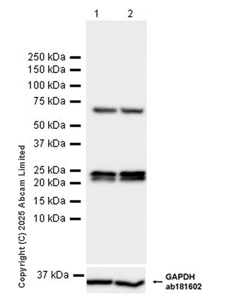 Western blot - Anti-VIP antibody [EPR28121-6] (AB324196), expandable thumbnail
