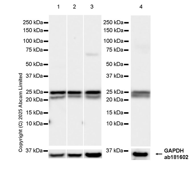 Western blot - Anti-VIP antibody [EPR28121-6] (AB324196), expandable thumbnail