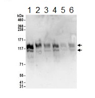Western blot - Anti-VIP2 antibody (AB183527)