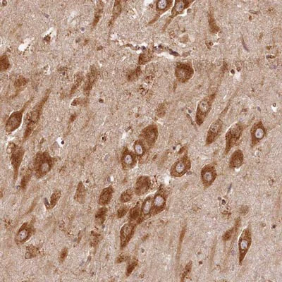 Immunohistochemistry (Formalin/PFA-fixed paraffin-embedded sections) - Anti-VIP2 antibody (AB204374)