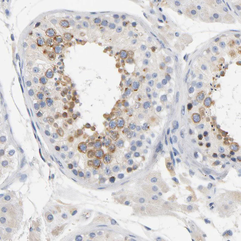 Immunohistochemistry (Formalin/PFA-fixed paraffin-embedded sections) - Anti-VIP36 antibody (AB224227)