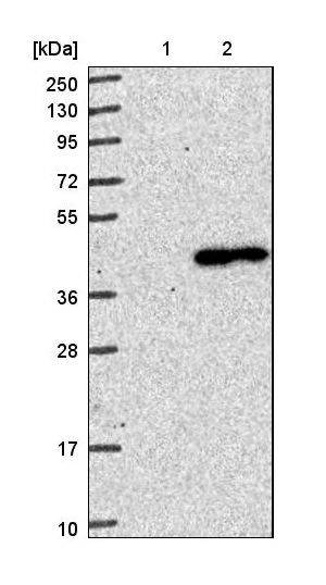 Western blot - Anti-VIP36 antibody (AB224227)