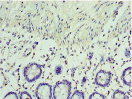 Immunohistochemistry (Formalin/PFA-fixed paraffin-embedded sections) - Anti-Viperin antibody (AB236297)