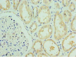 Immunohistochemistry (Formalin/PFA-fixed paraffin-embedded sections) - Anti-Viperin antibody (AB236297)