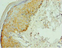 Immunohistochemistry (Formalin/PFA-fixed paraffin-embedded sections) - Anti-Viperin antibody (AB236297)
