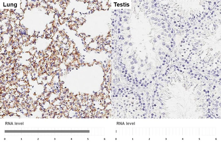 Immunohistochemistry (Formalin/PFA-fixed paraffin-embedded sections) - Anti-VIPR2 antibody [HL3625] - BSA and Azide free (AB325876)