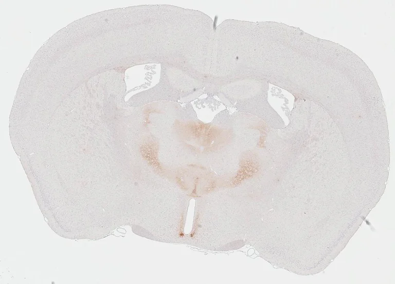 Immunohistochemistry (Formalin/PFA-fixed paraffin-embedded sections) - Anti-VIPR2 antibody [HL3625] - BSA and Azide free (AB325876)