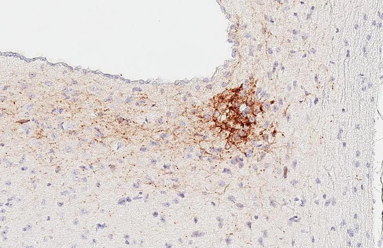 Immunohistochemistry (Formalin/PFA-fixed paraffin-embedded sections) - Anti-VIPR2 antibody [HL3625] - BSA and Azide free (AB325876)