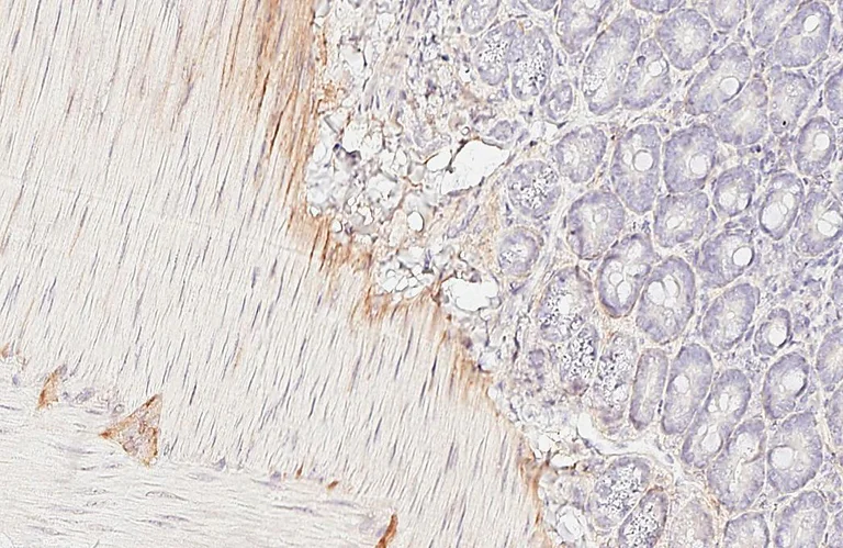 Immunohistochemistry (Formalin/PFA-fixed paraffin-embedded sections) - Anti-VIPR2 antibody [HL3625] - BSA and Azide free (AB325876)
