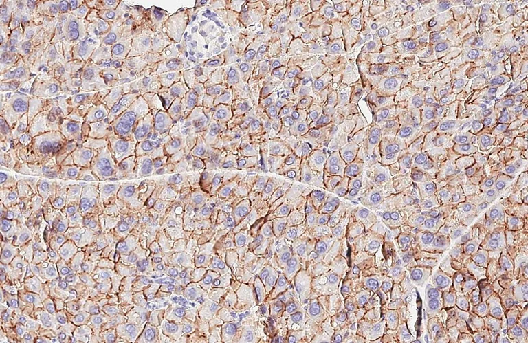 Immunohistochemistry (Formalin/PFA-fixed paraffin-embedded sections) - Anti-VIPR2 antibody [HL3625] - BSA and Azide free (AB325876)