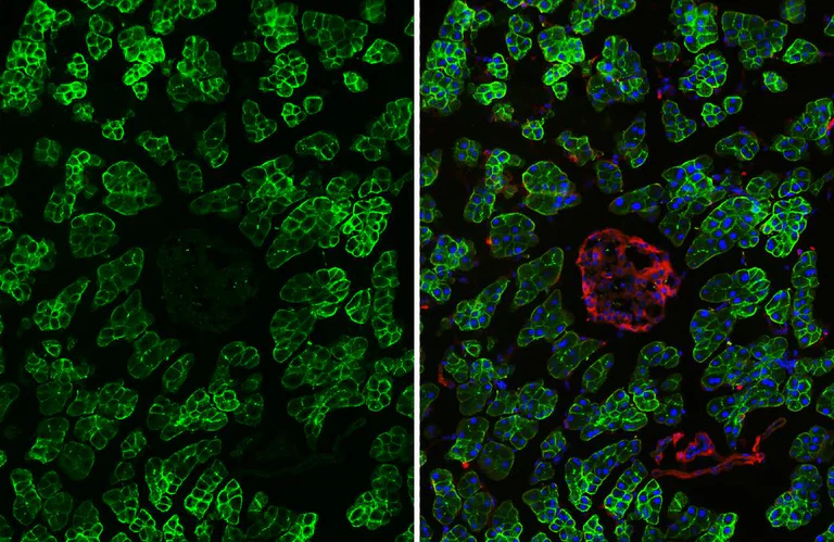 Immunohistochemistry (Frozen sections) - Anti-VIPR2 antibody [HL3625] - BSA and Azide free (AB325876)