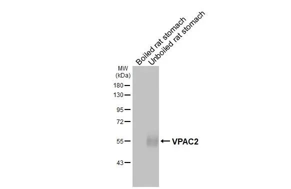 Western blot - Anti-VIPR2 antibody [HL3625] - BSA and Azide free (AB325876)