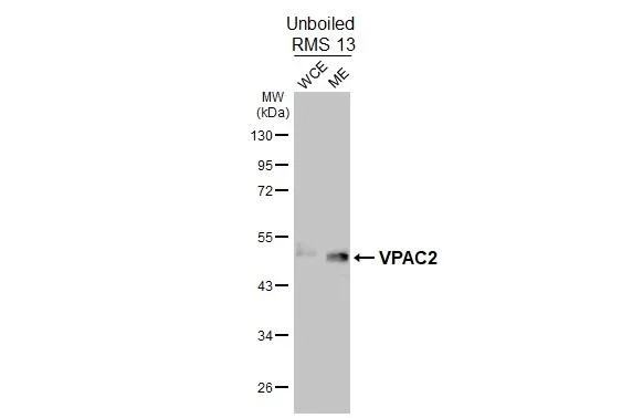 Western blot - Anti-VIPR2 antibody [HL3625] - BSA and Azide free (AB325876)