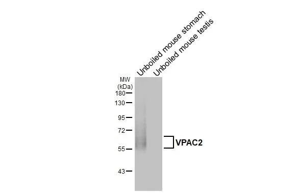 Western blot - Anti-VIPR2 antibody [HL3625] - BSA and Azide free (AB325876)