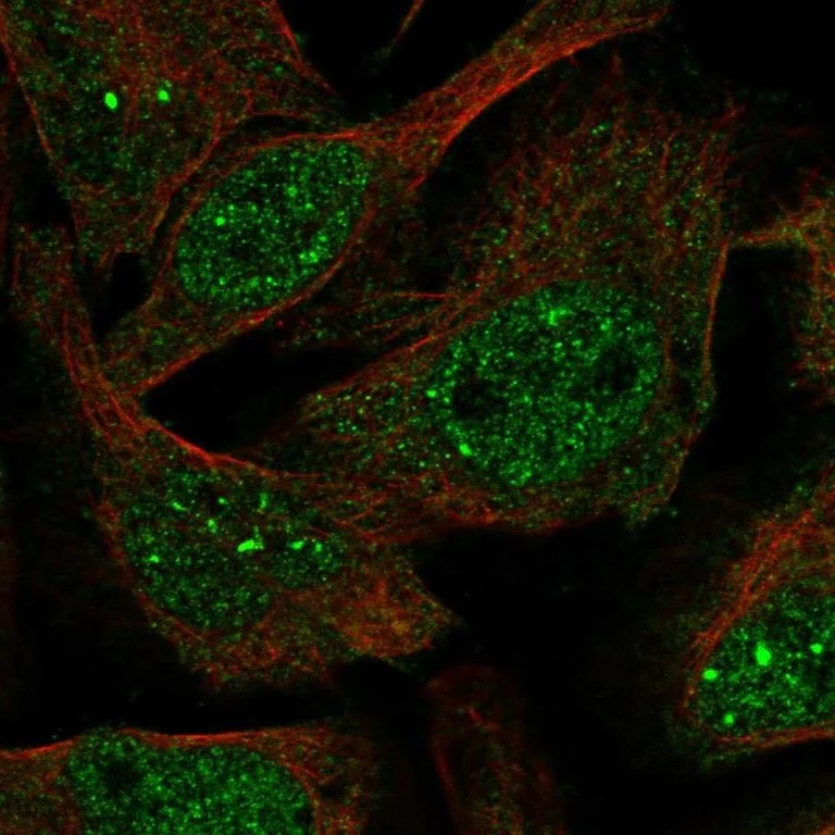 Immunocytochemistry/ Immunofluorescence - Anti-VIRMA/KIAA1429 antibody (AB246982)