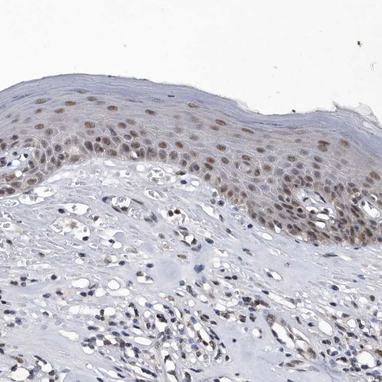 Immunohistochemistry (Formalin/PFA-fixed paraffin-embedded sections) - Anti-VIRMA/KIAA1429 antibody (AB246982)