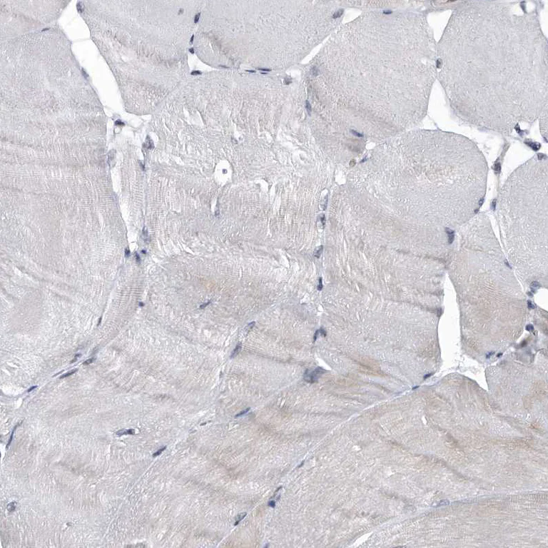 Immunohistochemistry (Formalin/PFA-fixed paraffin-embedded sections) - Anti-VIRMA/KIAA1429 antibody (AB246982)