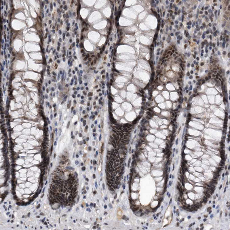 Immunohistochemistry (Formalin/PFA-fixed paraffin-embedded sections) - Anti-VIRMA/KIAA1429 antibody (AB246982)