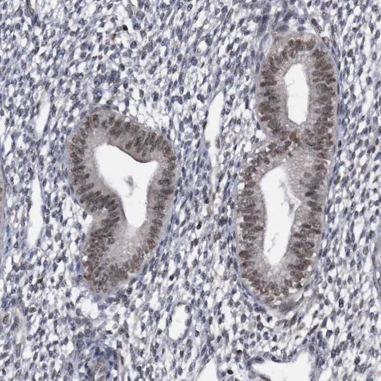 Immunohistochemistry (Formalin/PFA-fixed paraffin-embedded sections) - Anti-VIRMA/KIAA1429 antibody (AB246982)