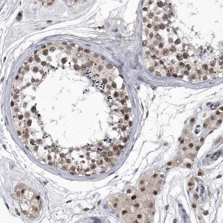 Immunohistochemistry (Formalin/PFA-fixed paraffin-embedded sections) - Anti-VIRMA/KIAA1429 antibody (AB246982)
