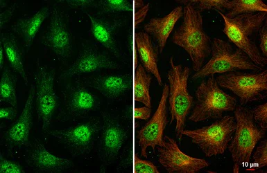 Immunocytochemistry/ Immunofluorescence - Anti-VIRMA/KIAA1429 antibody [HL1719] (AB308190)
