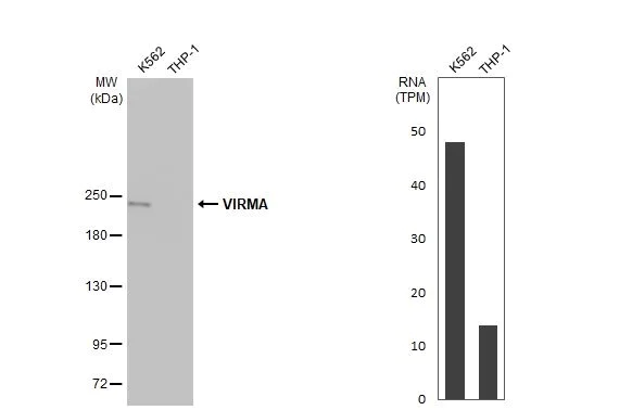 Western blot - Anti-VIRMA/KIAA1429 antibody [HL1719] (AB308190)