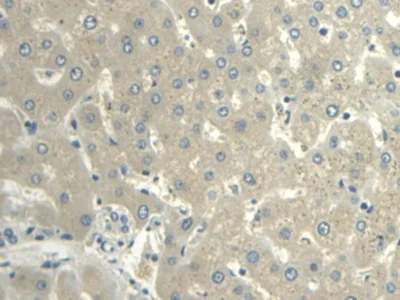 Immunohistochemistry (Formalin/PFA-fixed paraffin-embedded sections) - Anti-Visfatin antibody (AB233294)