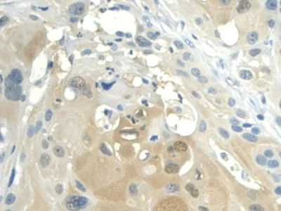 Immunohistochemistry (Formalin/PFA-fixed paraffin-embedded sections) - Anti-Visfatin antibody (AB233294)