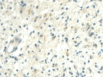 Immunohistochemistry (Formalin/PFA-fixed paraffin-embedded sections) - Anti-Visfatin antibody (AB233294)