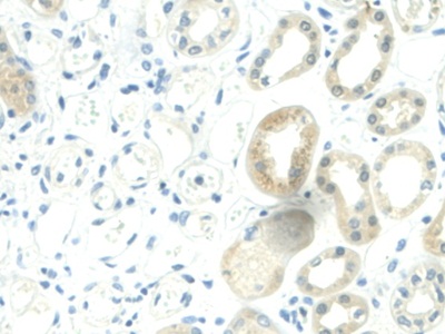 Immunohistochemistry (Formalin/PFA-fixed paraffin-embedded sections) - Anti-Visfatin antibody (AB233294)