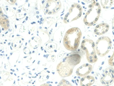 Immunohistochemistry (Formalin/PFA-fixed paraffin-embedded sections) - Anti-Visfatin antibody (AB233294)