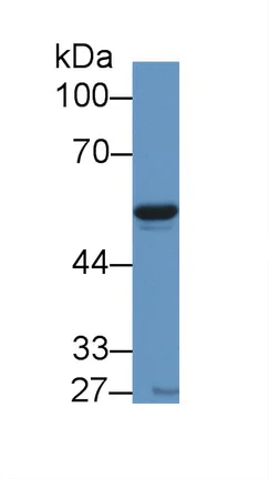 Western blot - Anti-Visfatin antibody (AB233294)