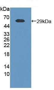 Western blot - Anti-Visfatin antibody (AB233294)