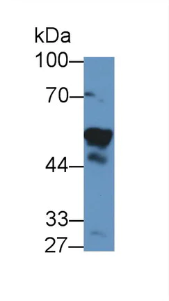 Western blot - Anti-Visfatin antibody (AB233294)