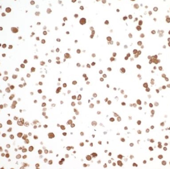 Immunocytochemistry/ Immunofluorescence - Anti-Visfatin antibody [BLR058F] (AB252558), expandable thumbnail
