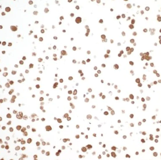 Immunocytochemistry/ Immunofluorescence - Anti-Visfatin antibody [BLR058F] (AB252558)