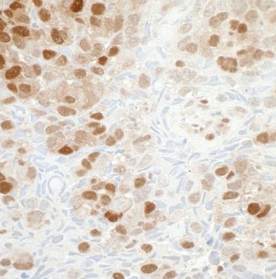 Immunohistochemistry (Formalin/PFA-fixed paraffin-embedded sections) - Anti-Visfatin antibody [BLR058F] (AB252558), expandable thumbnail