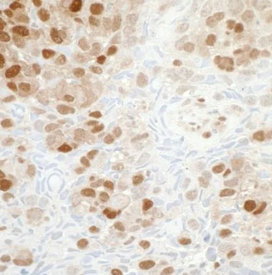 Immunohistochemistry (Formalin/PFA-fixed paraffin-embedded sections) - Anti-Visfatin antibody [BLR058F] (AB252558)