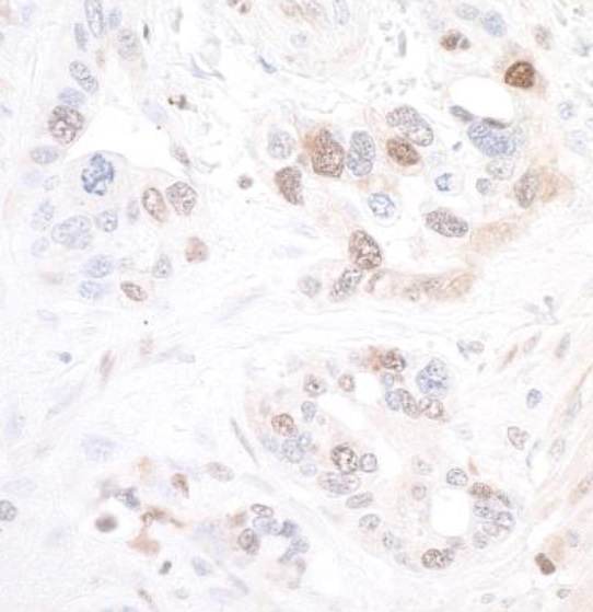 Immunohistochemistry (Formalin/PFA-fixed paraffin-embedded sections) - Anti-Visfatin antibody [BLR058F] (AB252558), expandable thumbnail